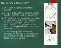 Slit Skin Smear Cara Baca Nya